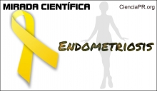 Mirada Cientifica Podcast - Endometriosis